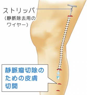 日帰り手術